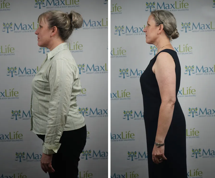 MaxLife client side profile before and after following the protocol