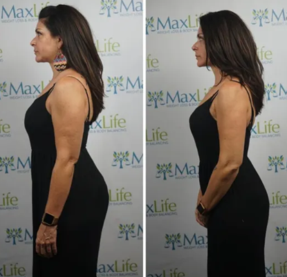 MaxLife client side profile before and after the metabolic reset
