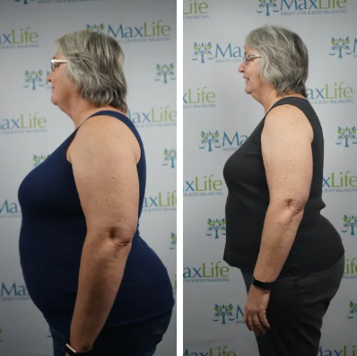 MaxLife client side profile before and after the program